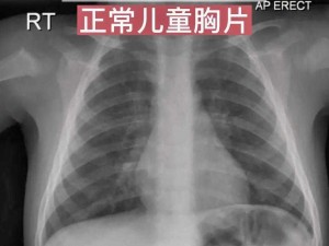 十大曝光胸片;十大曝光胸片：揭示医学真相，守护健康未来